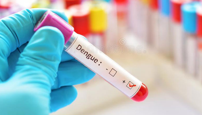 سنڌ هيلٿ ڪيئر ڪميشن پاران ڊينگي، مليريا ۽ سي بي سي ٽيسٽن جي اگهن ۾ گهٽتائي جو اعلان۔